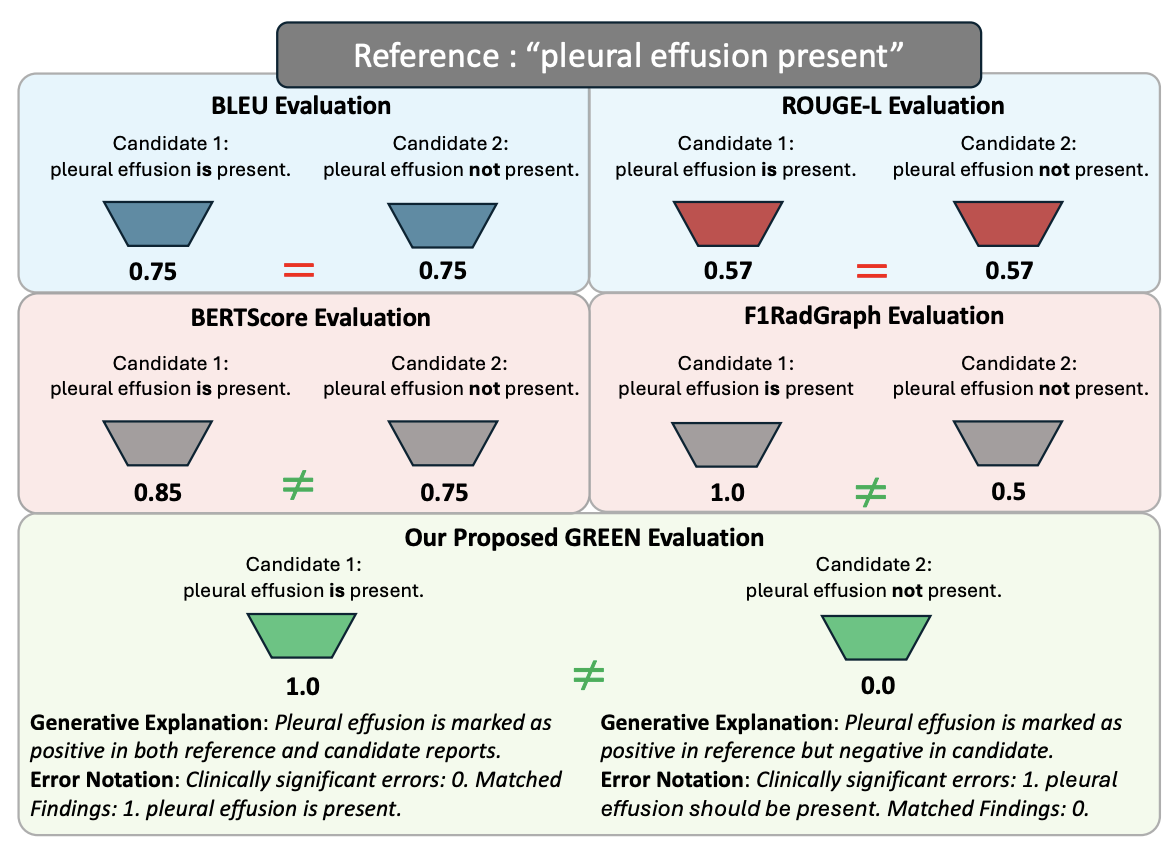 GREEN evaluation compared with BLEU, ROUGE-L, BERTScore, and F1RadGraph on a pleural effusion example
